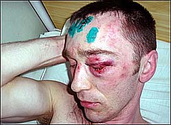 ������ ��������� � �������.